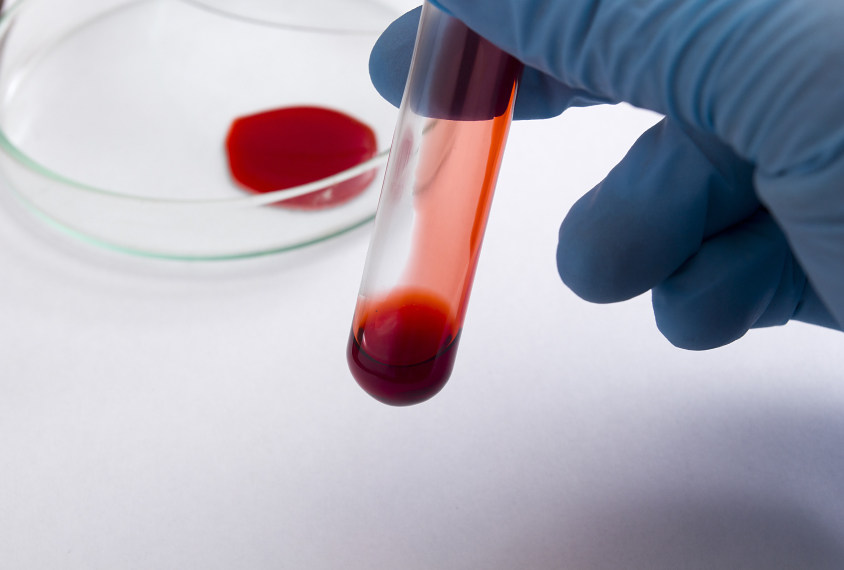 Blood Analysis Melbourne